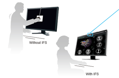 sonde de calibration intégrée écran médical EIZO Radiforce RX660