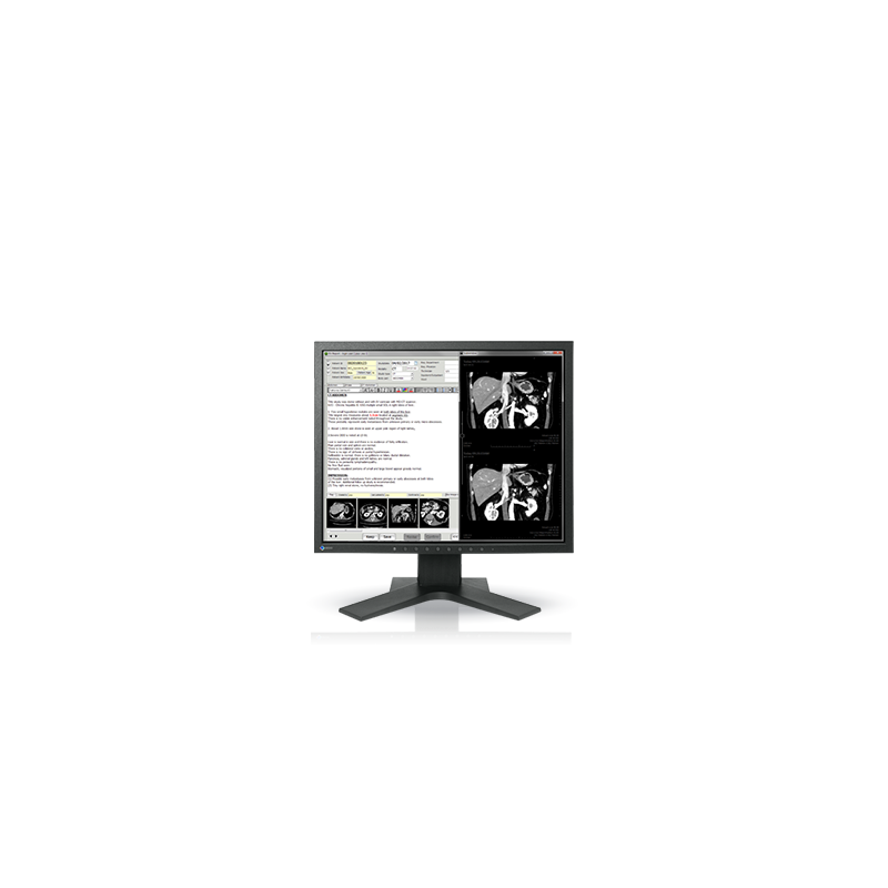 Ecran EIZO RadiForce MX194