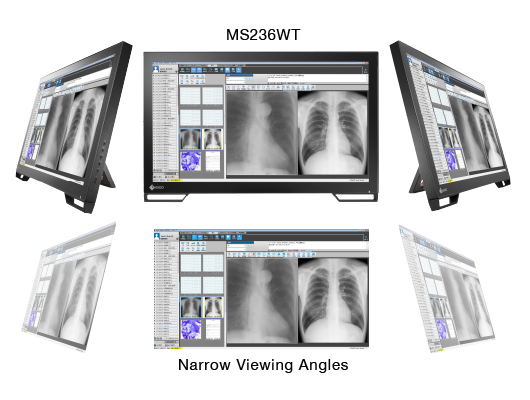 grand angle de vision écran médical tactile eizo radiforce ms236wt